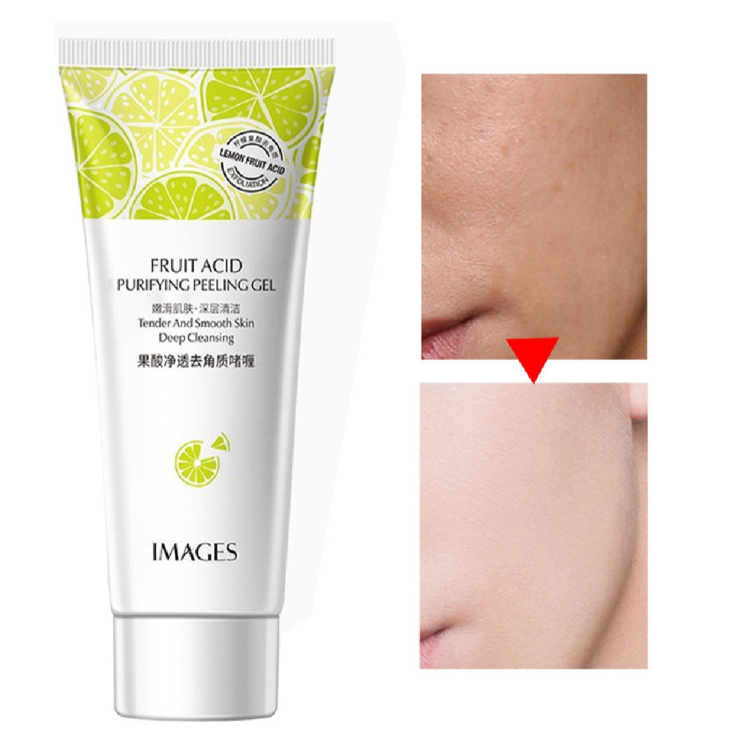 Fruit Acid Purifying Peeling Gel Facial Scrub Cleanser Wash Deep Cleansing Exfoliating Whitening Brightening Moisturizing Hydrating Blackhead Removal Oil Control Shrink Pores Skin Care