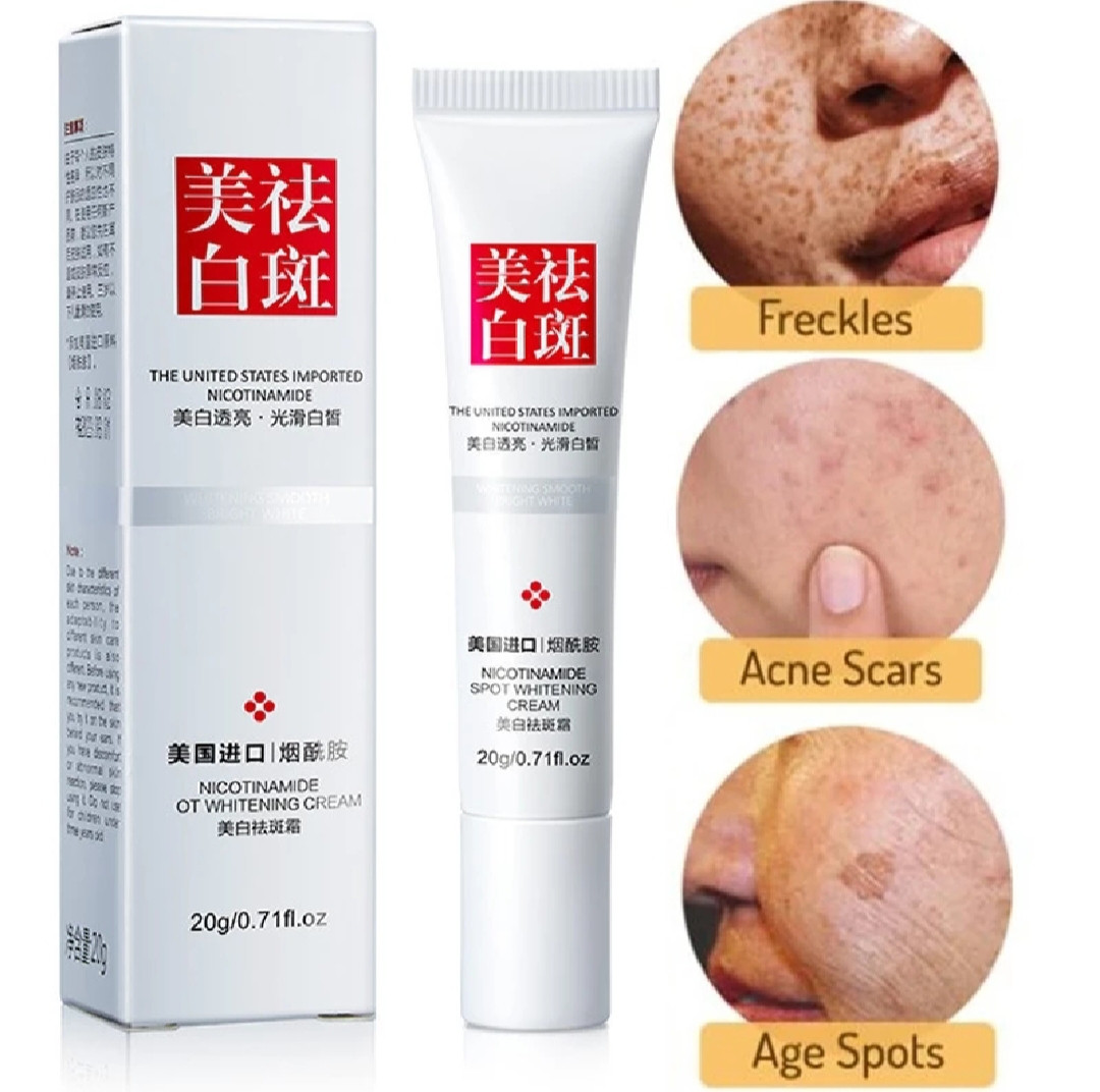 Freckle Removal Cream Whitening Anti Melasma Removal and Dark Spots Cream Effective Acne Scars 20g