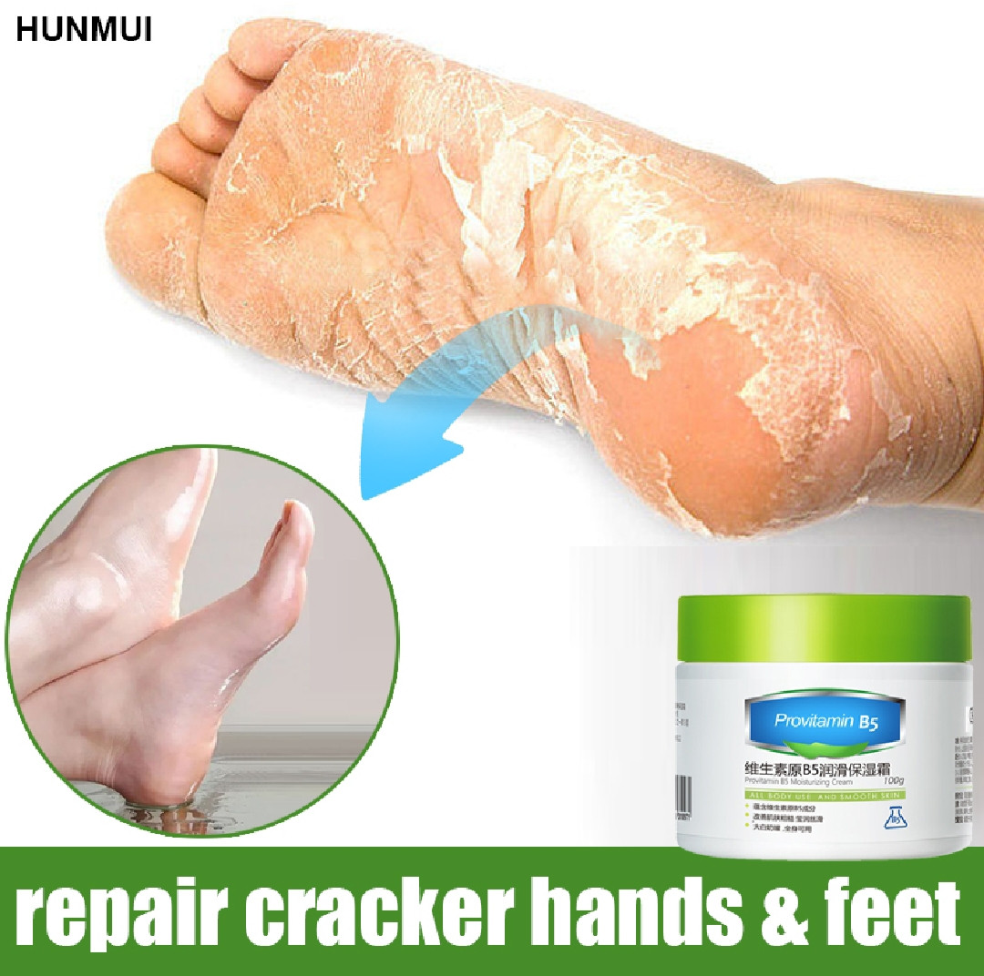 Hunmui Vaseline Moisturizing Cream For Face Provitamin B5 Body Hand Foot Skin Cream Whitening Remove Drying Dead Skin Whole Body Can Use Hydrating Antifreeze Cream Anti-cracking Drying Cream 100g