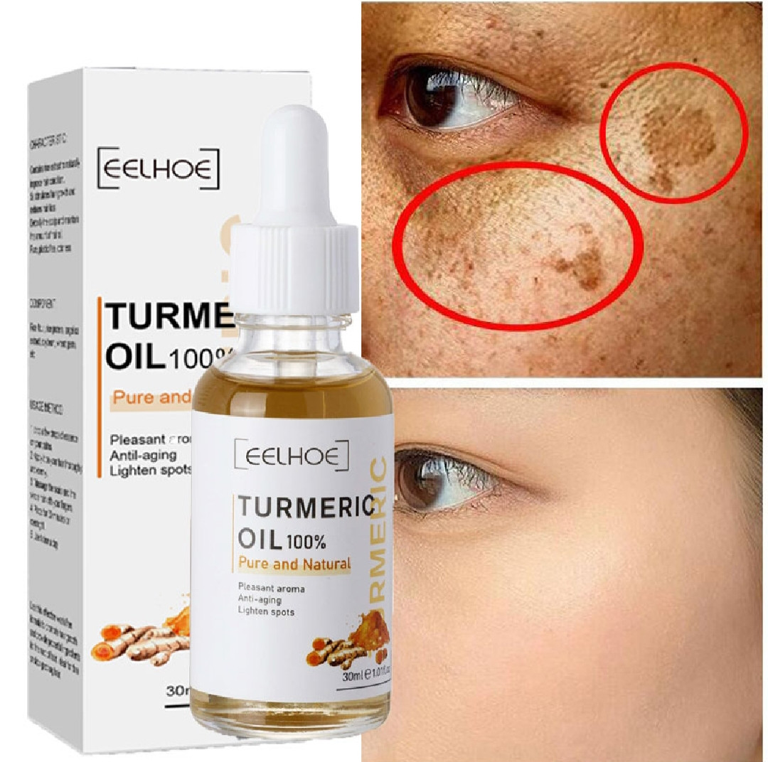 30ml pure turmeric essential oil freckle whitening serum brighten fade acne dark spot pigmentation melanin moisturizing corrector beauty face skin care