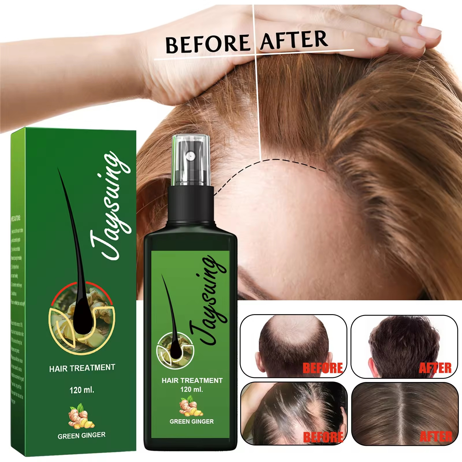 120ml ginger hair growth spray anti-hair loss baldness strengthens hair roots moisturize thick hair anti-fall scalp massage repair serum spray