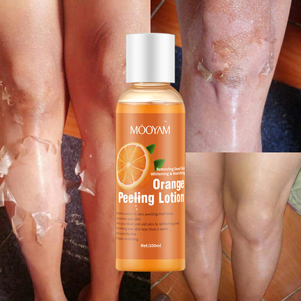 Orange Peeling Lotion Peeling Oil Body Lotion Gentle Exfoliating Gel Orange Peeling Lotion